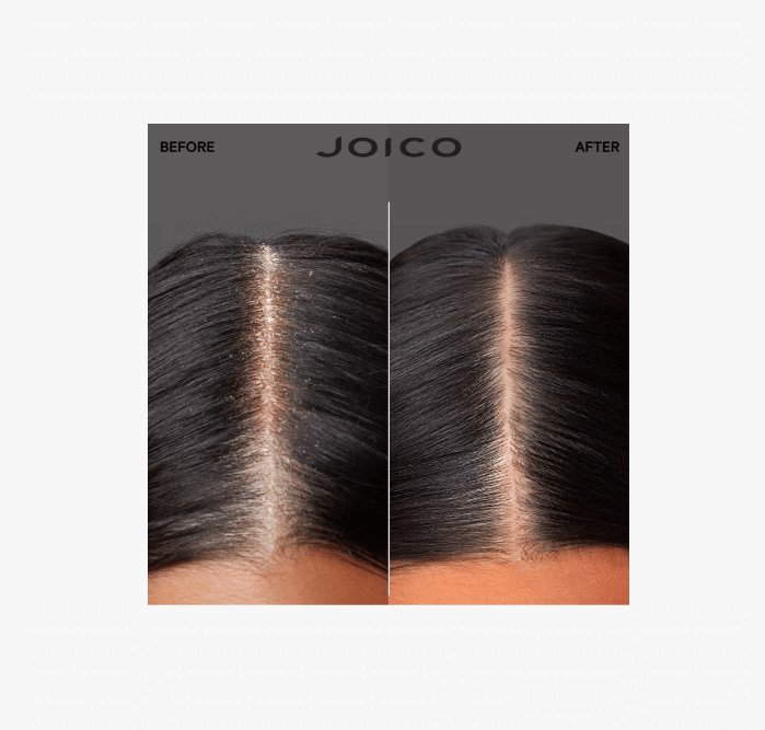 Product Image for Joico Scalp Vitality Exfoliating Foaming Scrub